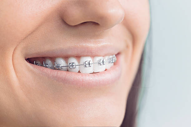 Best Traditional Braces  in Plymouth, OH
